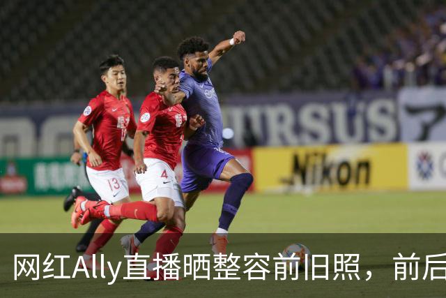 网红Ally直播晒整容前旧照，前后差距巨大，称放出照片要巨大勇气